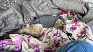 Fernanda Cardoso Setti - Doença renal da Zadar c/ 3 cirurgias