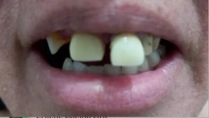 Vaquinha Online - AJUDE A ERILENE A FAZER SEU TRATAMENTO DENTÁRIO 