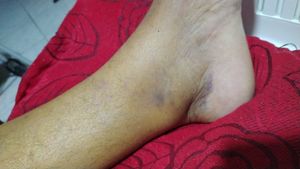 Vaquinha Online - Vaquinha Cirurgia de Urgência do Sr. José Carlos da Silva