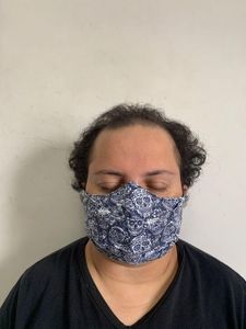 TRANSPLANTE CAPILAR DA JUNIA ALMEIDA imagem 6