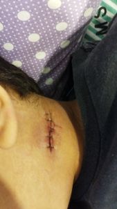 Vaquinha Online - Saúde do Lorenzo 