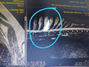 Crowdfunding - Ajude o Urso a operar a coluna e voltar a andar!