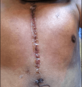 Vaquinha Online - Ajude Lucas 