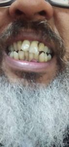 Vaquinha Online - Um sorriso renovado: Ajude-me a conquistar o meu sorriso!