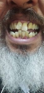 Saúde e Emergências - Um sorriso renovado: Ajude-me a conquistar o meu sorriso!