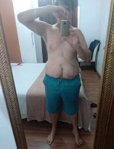 Projeto de incentivo a doação de órgãos imagem 7