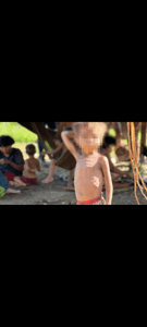 S.O.S YANOMAMI S.O.S imagem 6