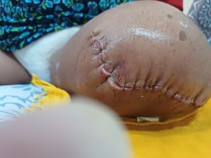 Tia Ceci - Ajude Tia Ceci a reconstruir sua vida! 