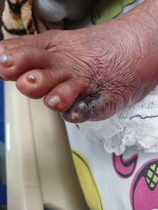 Vaquinha Online - Ajude Tia Ceci a reconstruir sua vida! 