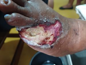 Financiamento Coletivo - Ajude Tia Ceci a reconstruir sua vida! 