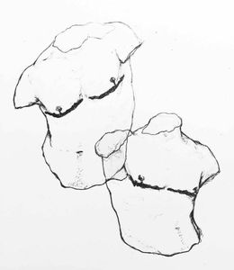 Santos/SP - A vaquinha do Ben - Mamoplastia Masculinizadora