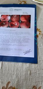 Vaquinha Online - Bicudo