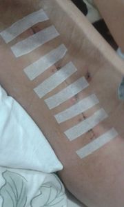 Saúde e Emergências - Cirurgia de Emêrgencia