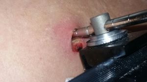 São Paulo/SP - Cirurgia de Emêrgencia