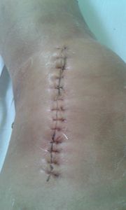 Andréa de Oliveira Romano - Cirurgia de Emêrgencia