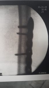 Cirurgia de Emêrgencia imagem 9