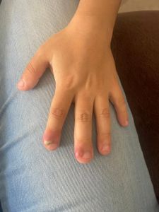 Ajude A Comprar O Medicamento Para O Caleb imagem 6