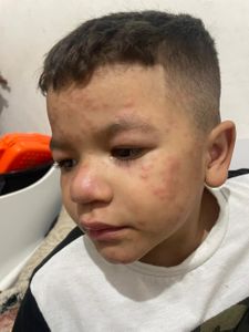 Saúde e Emergências - Ajude A Comprar O Medicamento Para O Caleb