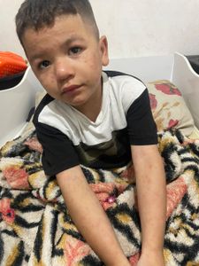 Mogi das Cruzes/SP - Ajude A Comprar O Medicamento Para O Caleb