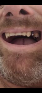 Vaquinha Online - Ajude o Ivaldo a Recuperar o Seu Sorriso!