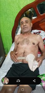 1 - Preciso de ajuda para fazer uma cirurgia de Colostomia, estou aguardando essa cirurgia Des de 2014