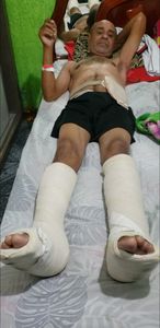 Saúde e Emergências - Preciso de ajuda para fazer uma cirurgia de Colostomia, estou aguardando essa cirurgia Des de 2014