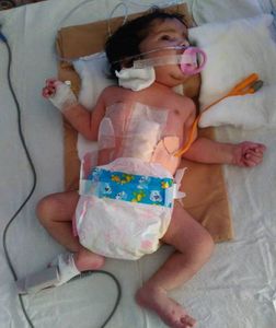 Crowdfunding - "Crianças com Câncer: Juntos pela Vida"