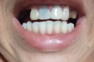 Saúde e Emergências - Me ajude a voltar sorrir pelo amor de Deus 