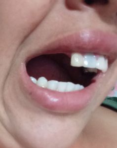 Vaquinha Online - Me ajude a voltar sorrir pelo amor de Deus 