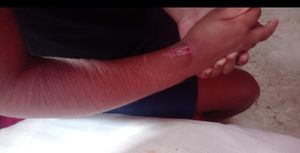 São José do Divino/MG - Ajudem na cirurgia da rhayla 