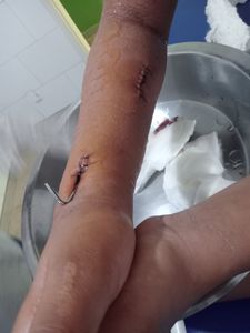 Cirurgia pra rhayla  - Ajudem na cirurgia da rhayla 