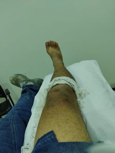 Saúde e Emergências - Pai acidentado precisa de ajuda para cirurgia e alimentação