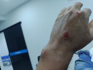 Vaquinha Online - Pai acidentado precisa de ajuda para cirurgia e alimentação