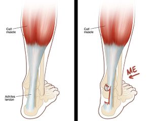 Vaquinha Online - Campanha para realização de minha cirurgia