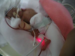 Vaquinha Online - Minha Bebê nasceu de 22 semanas com 444 gramas