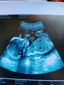 Financiamento Coletivo Parto do bébéfruit  - Parto do Bébéfruit 