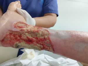 Ajude a Neuza a salvar a perna dela