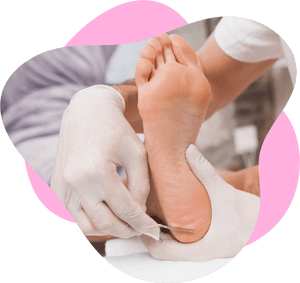 Plástica dos pés - Curso plástica dos pés funcionar?Quais os beneficios dos curso plásticas dos pés? Sabia tudos sobre o curso plástica dos pés 