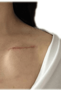 Campo Grande/MS - Coração que apanha 💔