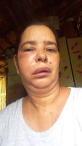 Ajuda pra comprar meus medicamentos, fazer uma casa, e pagar tratamento dos dentes  imagem 6