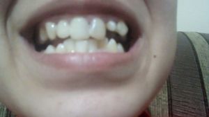 Vaquinha Online - Tratamento bucal 