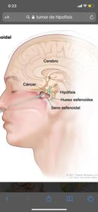 Vaquinha Online - Ajuda para cirurgia de retirada de tumor na cabeça.