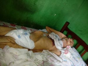 Saúde e Emergências - Ajudar manoel a vencer o câncer 