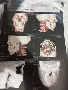 Dom Eliseu/PA - Vaquinha beneficente 