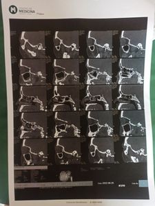 Preciso pagar anestesia para minha cirurgia dos seios da face com urgência  - Recadar dinheiro para pagar a anestesia da minha cirurgia dos seios da face