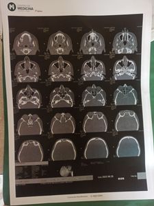 Saúde e Emergências - Recadar dinheiro para pagar a anestesia da minha cirurgia dos seios da face