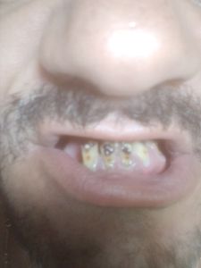 Saúde Mental - Sorriso e fazer outra pessoa sorrir 