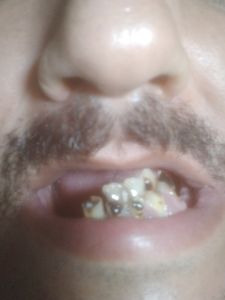 Nando jose - Sorriso e fazer outra pessoa sorrir 