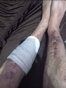 Causas e Comunidade - Preciso de ajuda financeira meu pix 47997605524