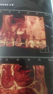 Ajude Gabi a sorrir  imagem 6